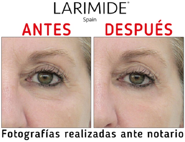 antes-despues_foto4.jpg