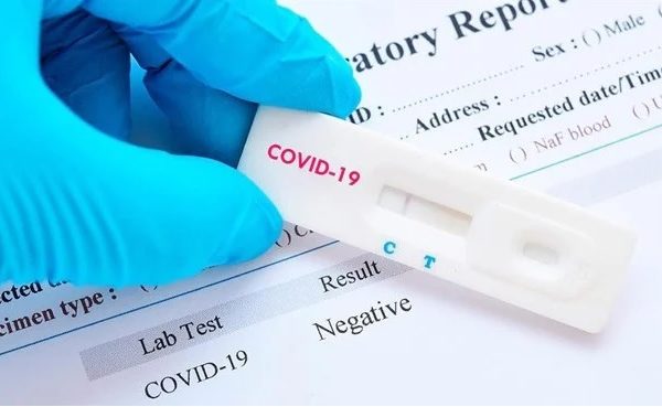 La Sanitat pública no fa test Covid als malalts lleus